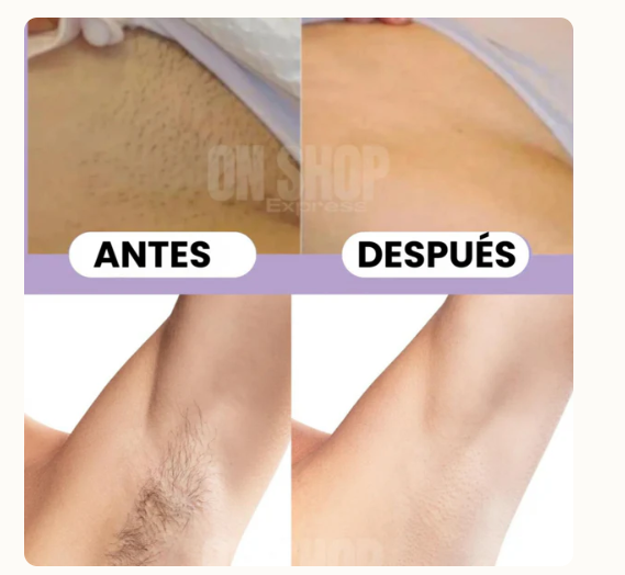 SilkLight Depiladora Sin Irritaciones Práctica y Portátil | Noare