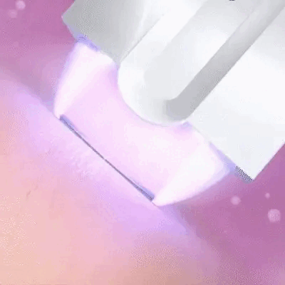 SilkLight Depiladora Sin Irritaciones Práctica y Portátil | Noare